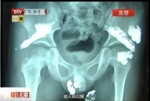 Dģ5qͯw(ni)@F(xin)ˮy